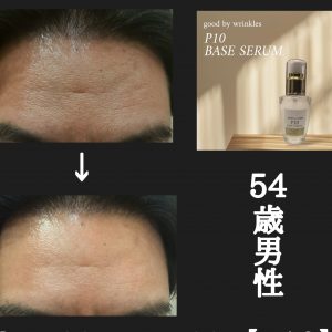気になるシワに直撃！！即効ケア出来る美容液。 | BLESS hair 表参道・原宿